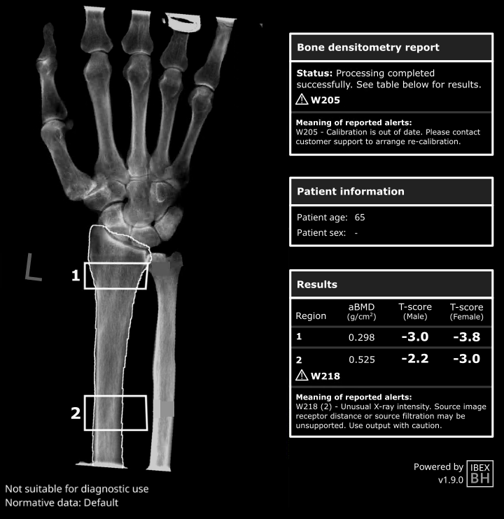 image (29).png Bone Densitometry Report Sample